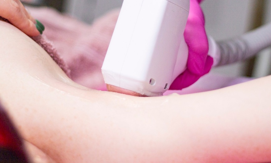 Image 7: Do 40% zniżki na: Depilacja laserowa w DS Beauty