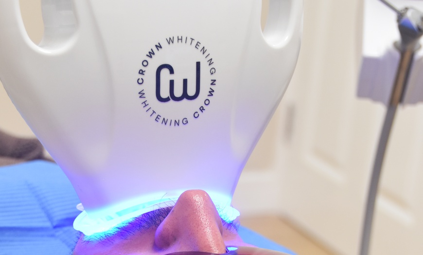 Image 3: Get a Brighter Smile in One Hour with Teeth Whitening, Consultation and Optional Whitening Kit (Up to 52% Off)