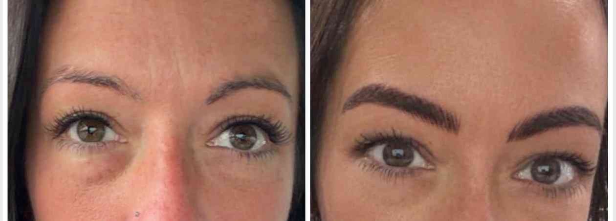 Perfect Brows with One Microblading Session with or without Touch-Up