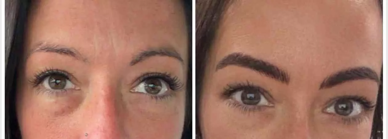 Perfect Brows with One Microblading Session with or without Touch-Up