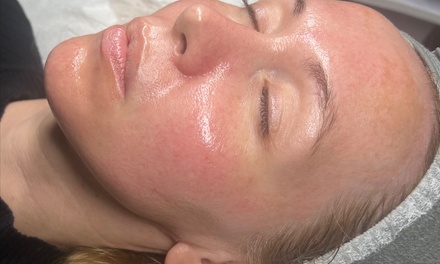 Hydro-facial  - Choose this if you don't know where to start - RefreshSkinTherapy