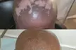 Up to 50% Off on Men and Women's Scalp Micropigmentation Treatments at Derma-Artistry Cosmetic Tattooing - Second Medium