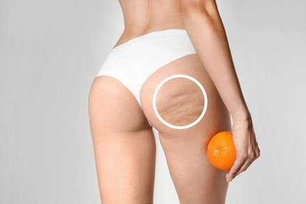 4 Treatments: Noninvasive Cellulite Treatment with Cellutone - Eros Beauty and Wellness