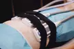Transform Your Body with Cryotherapy, Acupuncture and More at Tian Chao Herbs & Acupuncture (Up to 45% Off) - Second Medium