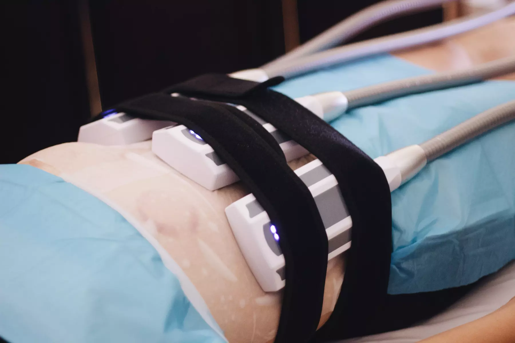 Rejuvenate Your Body: Cryotherapy, Acupuncture and More