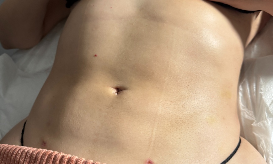 Image 2: Transform with 4, 8, or 12 Ultrasonic-Cavitation Slimming Sessions