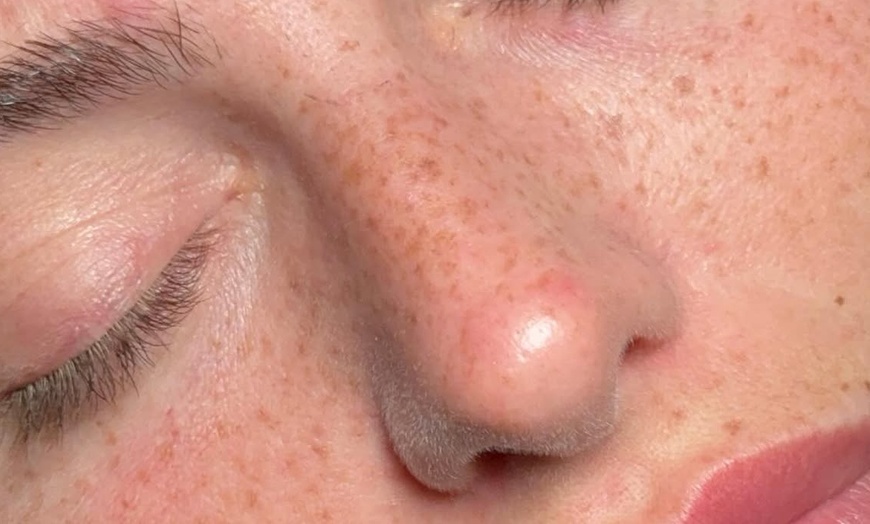 Image 3: Achieve Natural-Looking Freckles w/ Organic, Long-Lasting Application