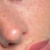 Image 3: Achieve Natural-Looking Freckles w/ Organic, Long-Lasting Application