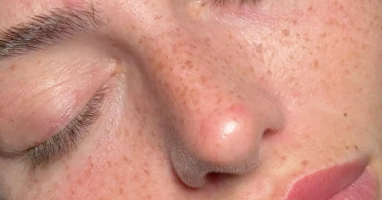Achieve Natural-Looking Freckles w/ Organic, Long-Lasting Application