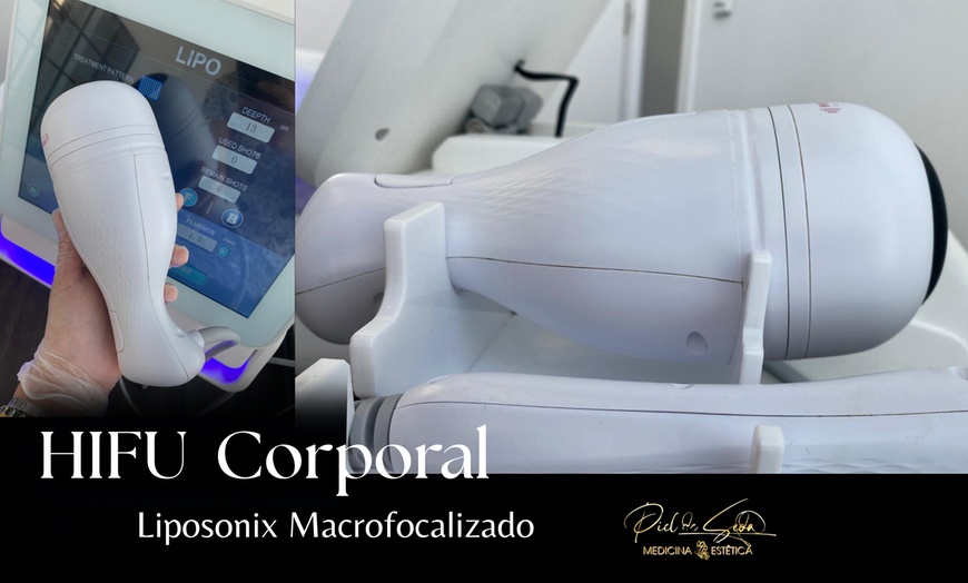 Image 7: Tratamiento HIFU facial o zona corporal con opción a radiofrecuencia