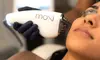 Comprehensive MOXI Laser Resurfacing – Face, Neck and Décolletage for up to 55% Off at Biorejuvenate