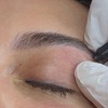 Image 4: Up to 30% Off on Electrolysis at La Belle Studio by Soraya