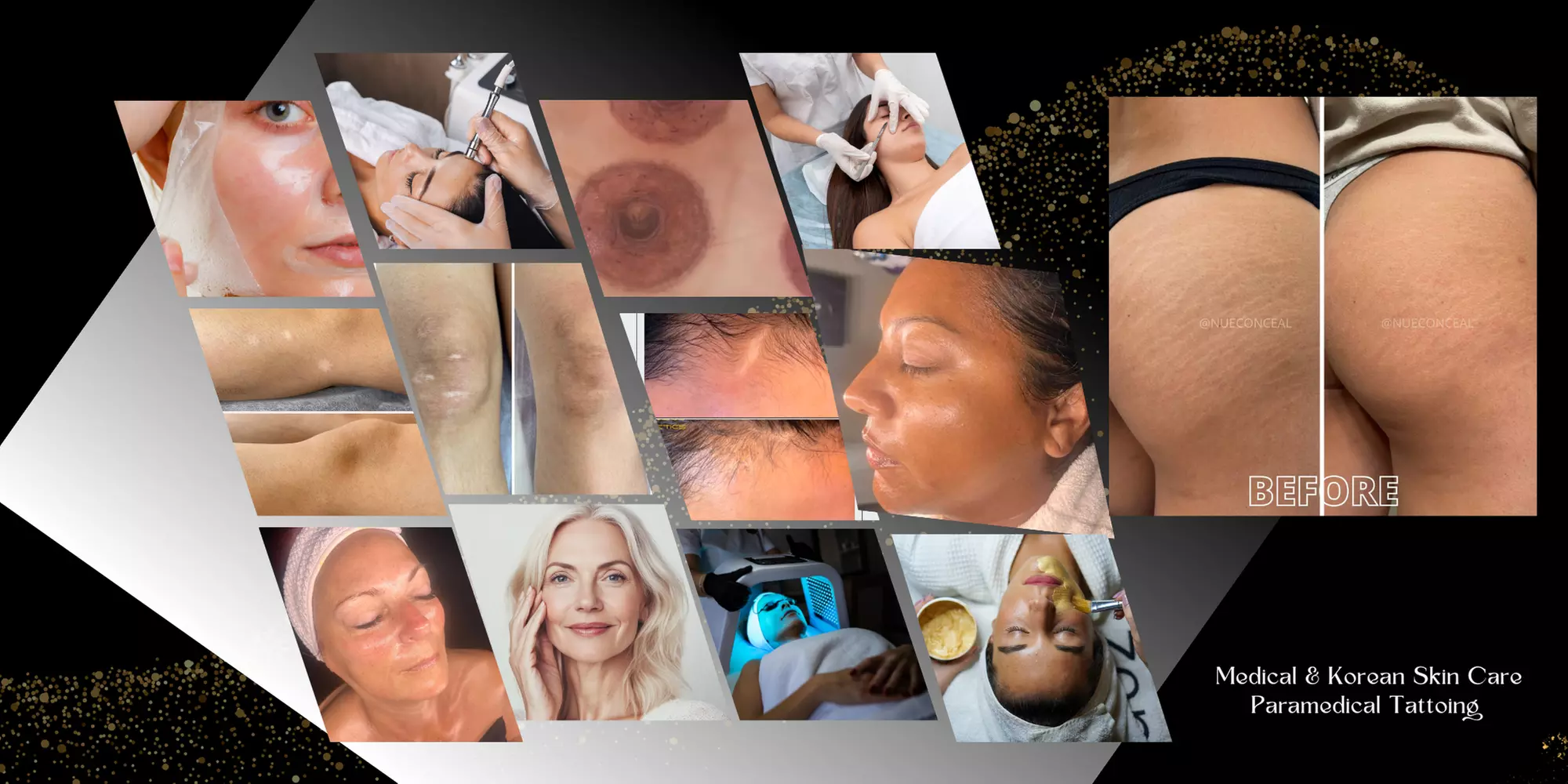 Up to 71% Off on Facial at LUXE Glow Skin Studio.