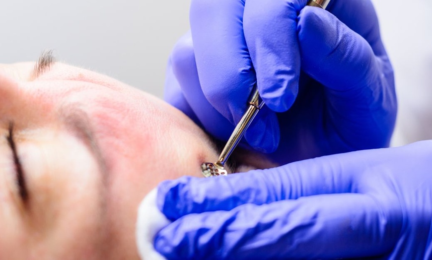 Image 5: 60 Min. Gesichtsbehandlung mit Tiefenreinigung und optionaler Massage