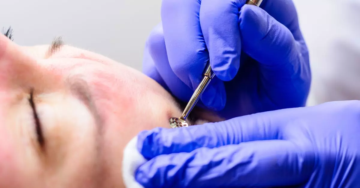 60 Min. Gesichtsbehandlung mit Tiefenreinigung und optionaler 30 Min. Massage für 1 Person (bis zu 33% sparen) - Second Medium