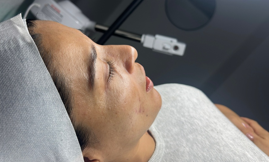 Image 1: One or Three Non-Surgical Face Lift: RF, Ultrasound & Cryo LED Facial 