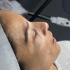 Image 1: Up to 30% Off on Facelift - Non-Surgical at Prasada skin