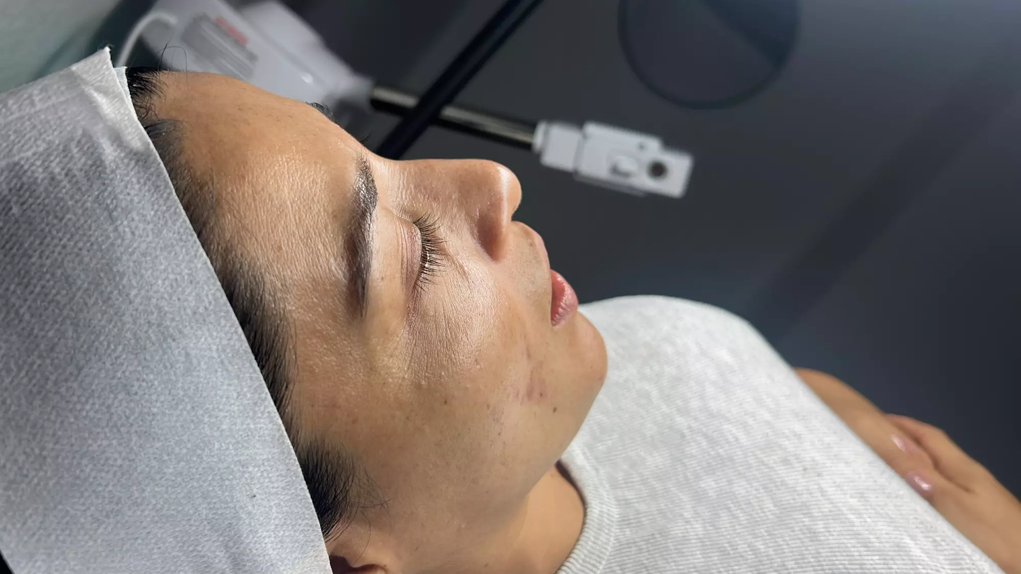 One or Three Non-Surgical Face Lift: RF, Ultrasound & Cryo LED Facial 