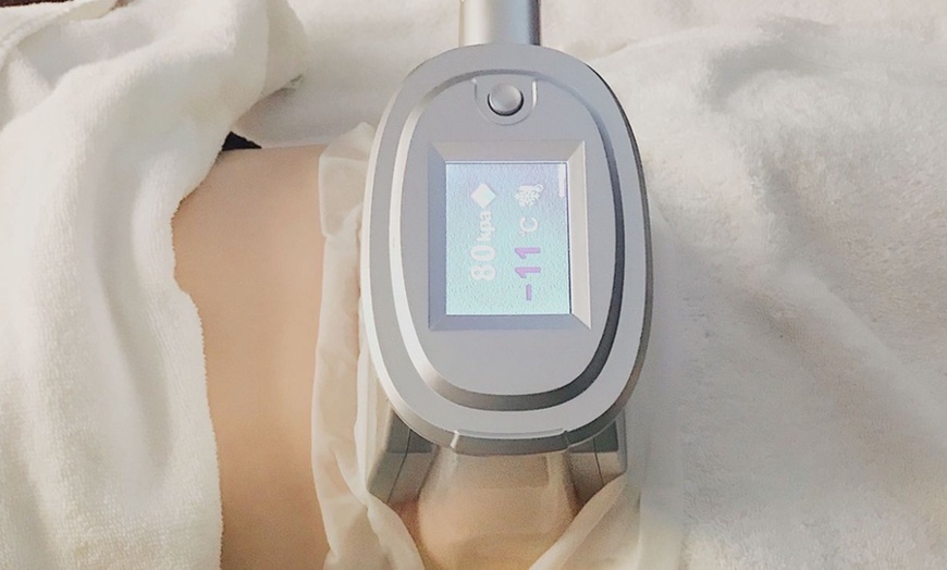 Image 3: Affiner son corps en douceur grâce à la cryolipolyse