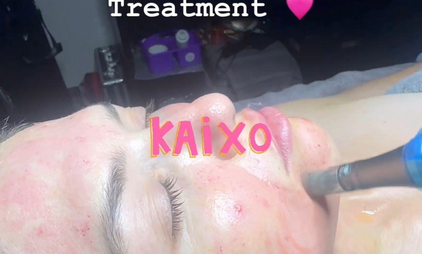 Image 1: Rejuvenate with Microneedles Exosomes Face and Neck