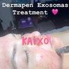 Image 1: Rejuvenate with Microneedles Exosomes Face and Neck