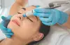 Up to 47% Off on Facial - Skin Lightening at 180°SkinRenewal