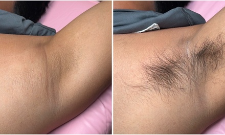 One Underarm Waxing - Beys Beauty Studio