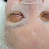 Image 7: One or Two Microneedling Treatments with Hyaluornic Acid and More