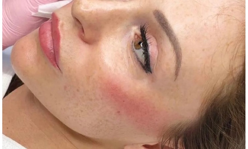 Image 4: Areola Tattoo Treatment, Scalp Micropigmentation Or Cheek Blush Tattoo