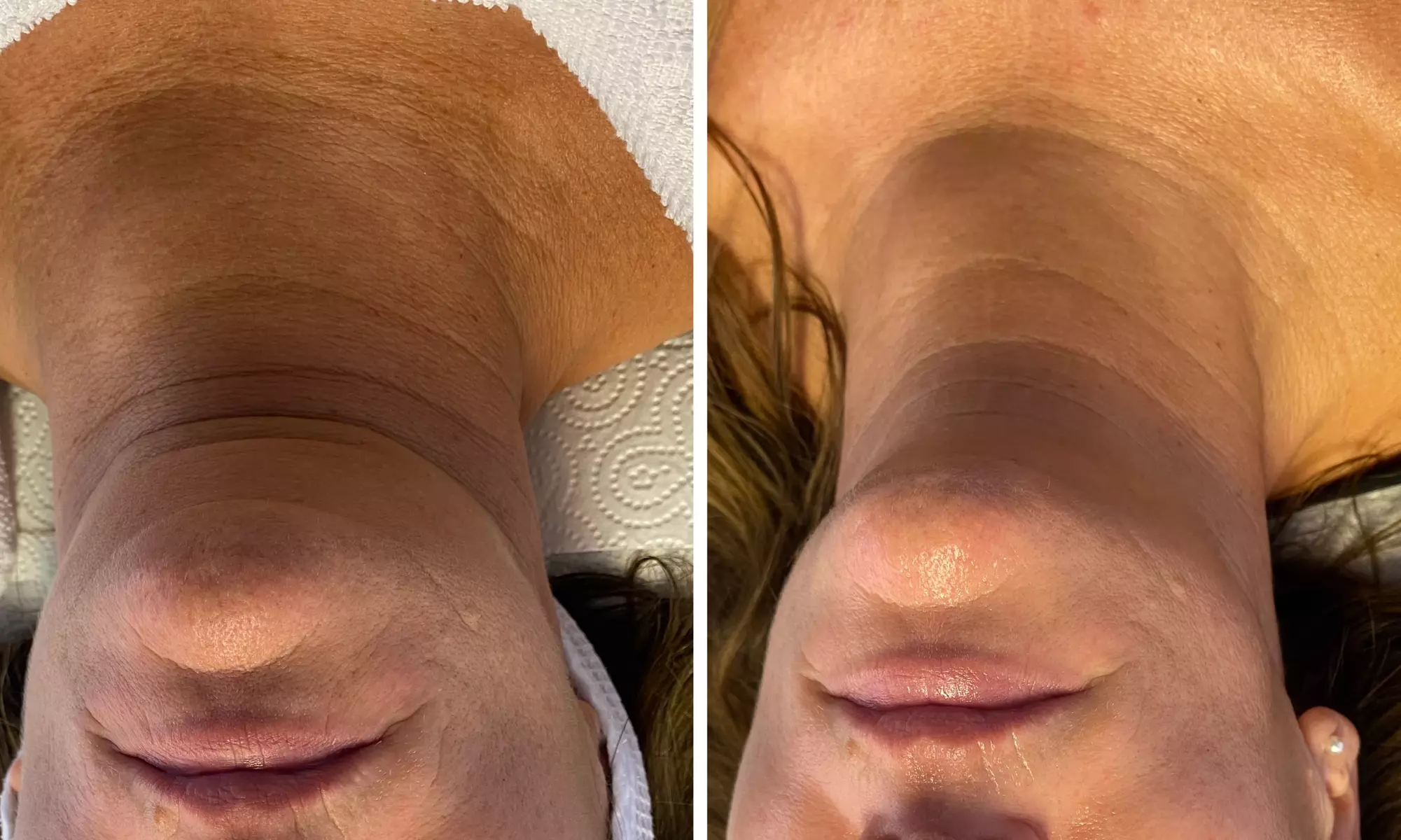 Oxygen HydraBoost Gesichtsbehandlung für 1 Person