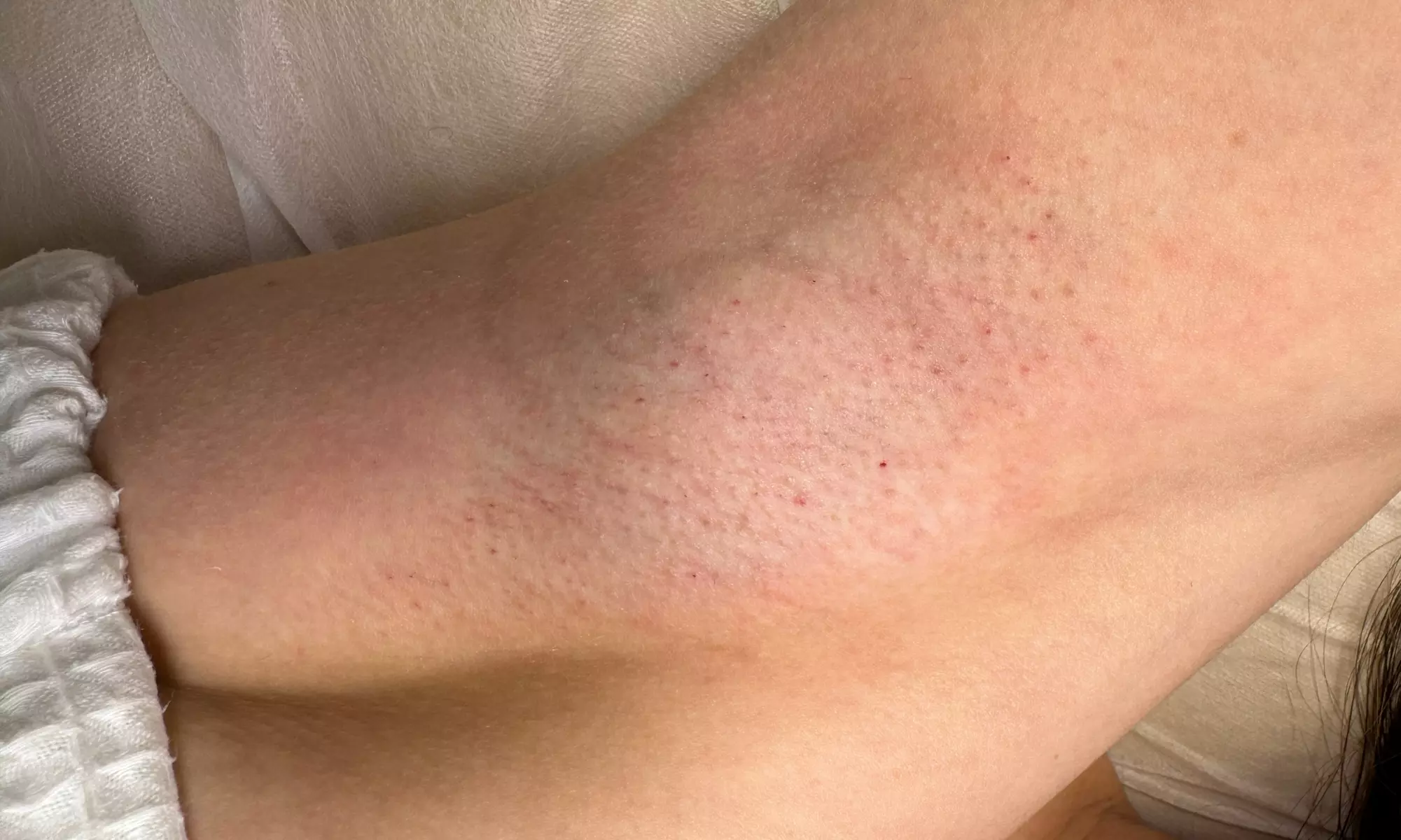 Summer-Ready with Brazilian Wax, Underarm, Brow, or Full Leg Options