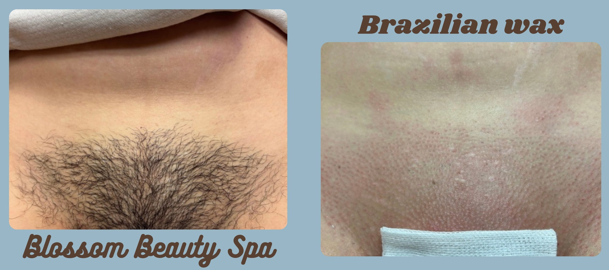 Full Leg & Brazilian Waxing Treatments for Smooth Skin and Confidence
