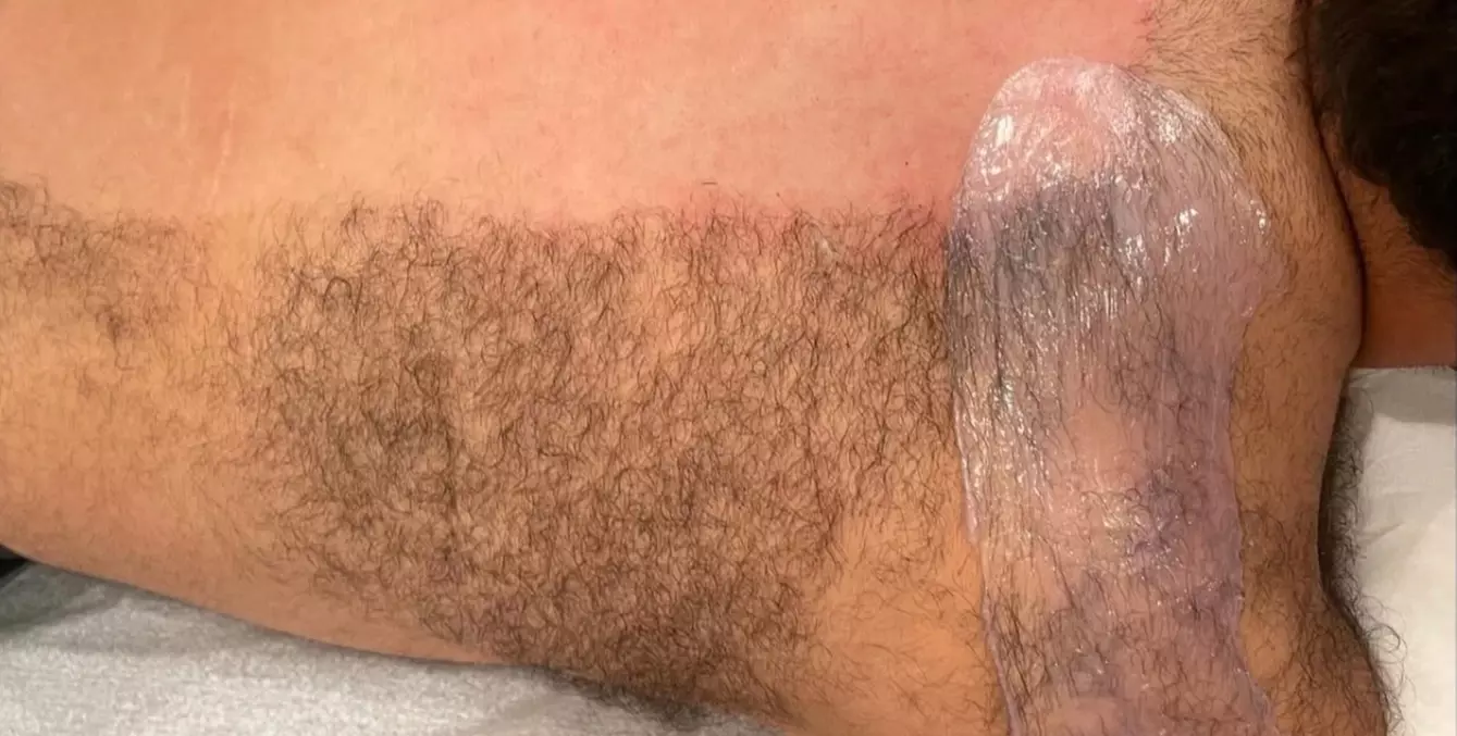 Feel Fresh with a One, Three or Five Brazilian Wax Sessions