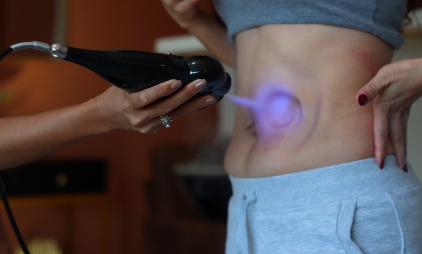 Image 3: Cryoslimming for Stubborn Abdominal Fat: No Surgery, No Downtime