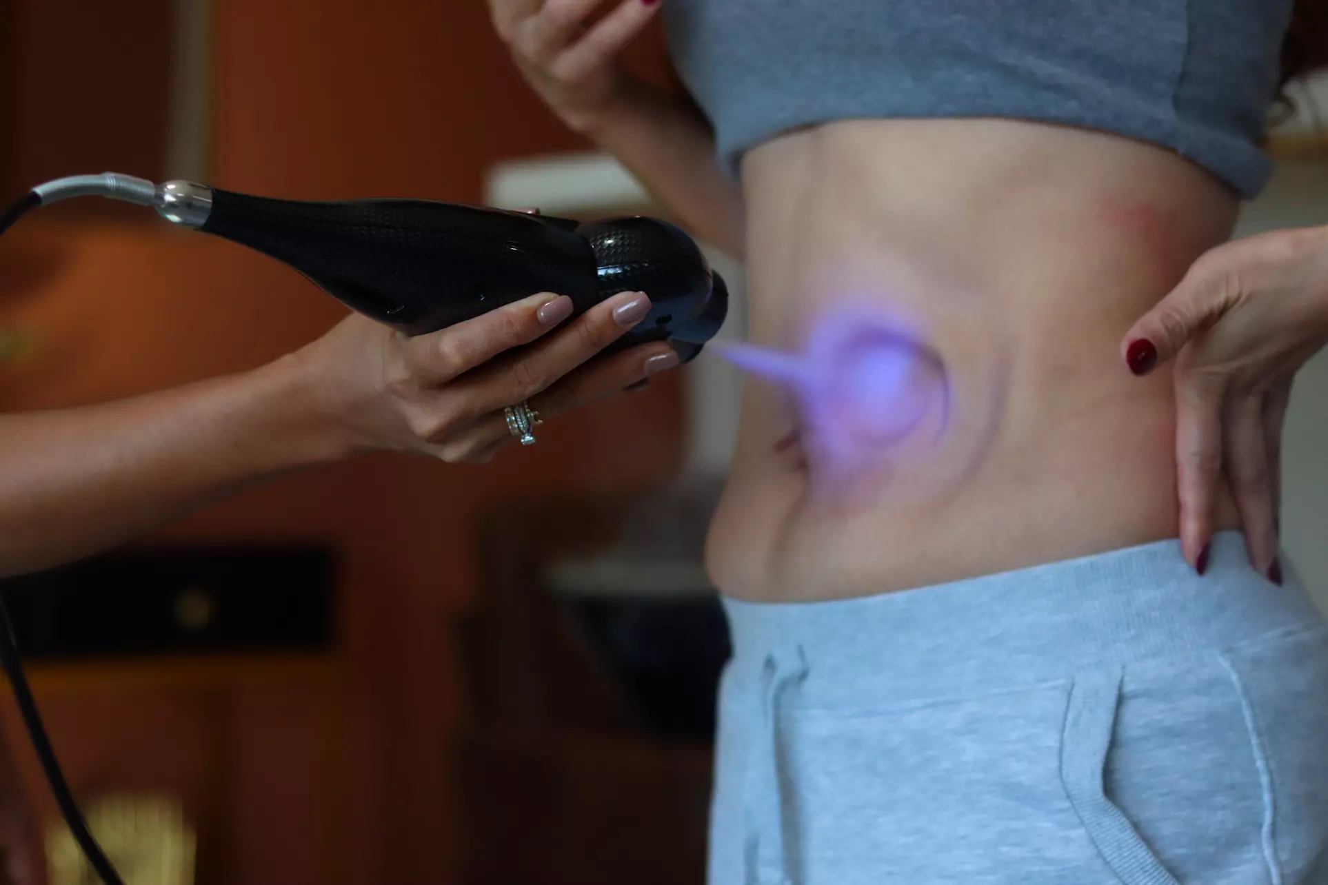 Cryoslimming for Stubborn Abdominal Fat: No Surgery, No Downtime