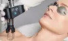 Rejuvenate with CoolPeel Laser Treatment by Professionals at Time 4 U Med Spa (Up to 38% Off)