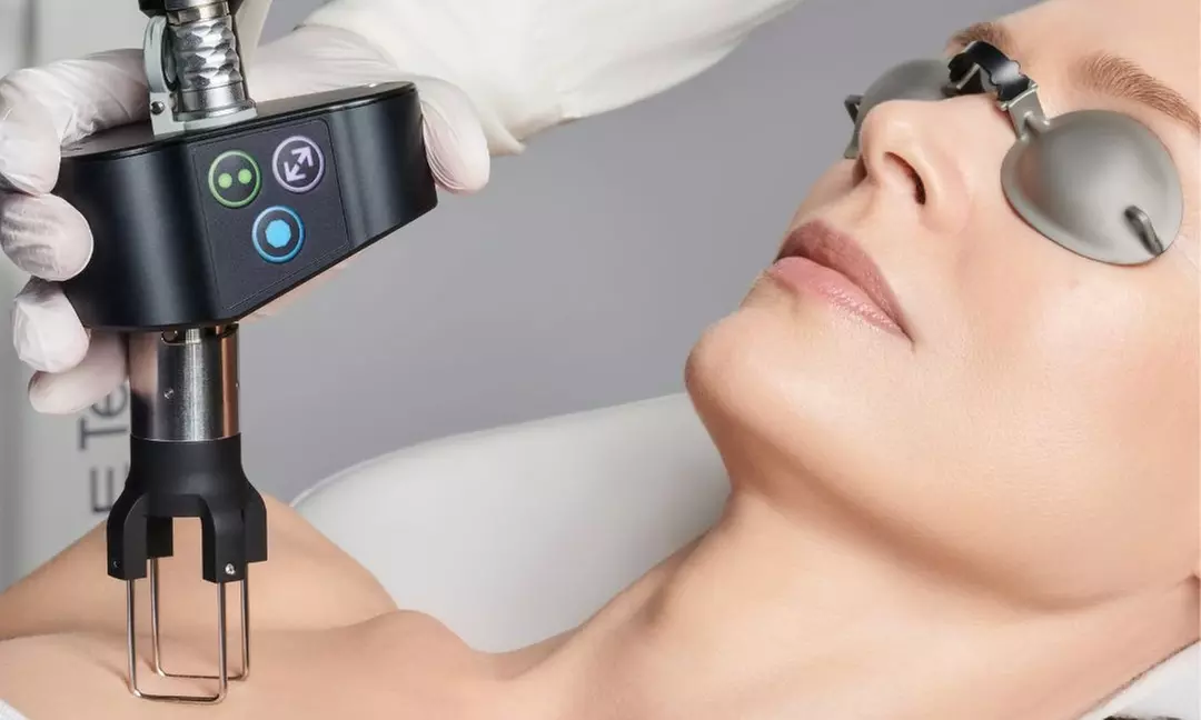 Rejuvenate with CoolPeel Laser Treatment by Professionals at Time 4 U Med Spa (Up to 38% Off) - Primary Image