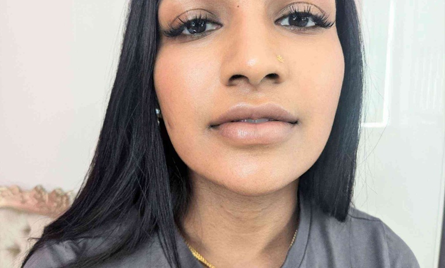 Image 1: Up to 60% Off on Injection - Filler and Freezer at Lux aesthetic & beauty LTD