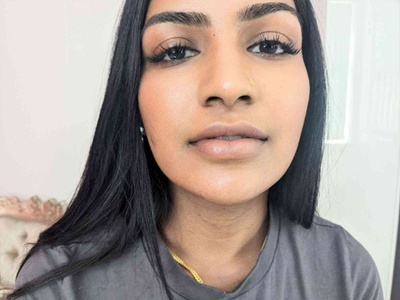 Polynucleotides 
Eye treatment 
Reduces dark circles and pigmentation - Lux aesthetic & beauty LTD