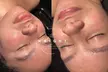 Experience rejuvenating in spa facials at The Wright Esthetics with options for up to 49% off. - Second Medium