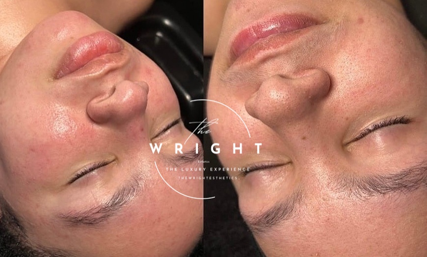 Image 2: Experience rejuvenating in spa facials at The Wright Esthetics with options for up to 49% off.