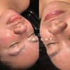Image 2: Experience rejuvenating in spa facials at The Wright Esthetics with options for up to 49% off.