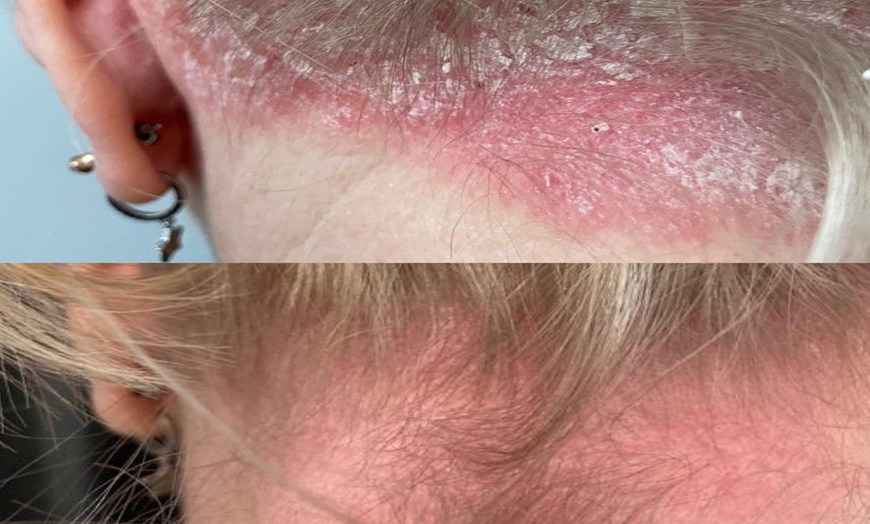 Image 6: Achieve Radiance with 6, 10, or 20 Dermalux MD Triwave LED Therapy 