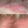 Image 6: Achieve Radiance with 6, 10, or 20 Dermalux MD Triwave LED Therapy 