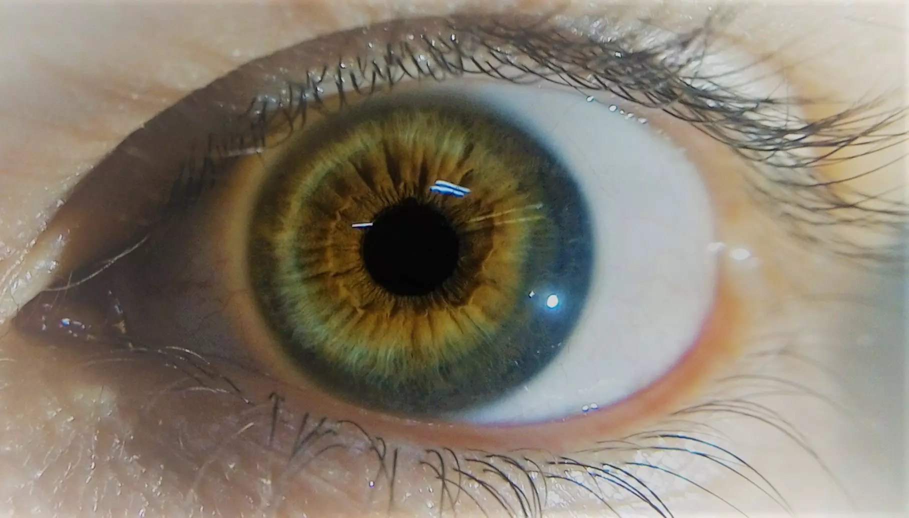 Explore Mission Clinic's Iridology Services, Offering Up to 35% Off for Holistic Medical Iris Exams with Herb Recommendations - Primary Image