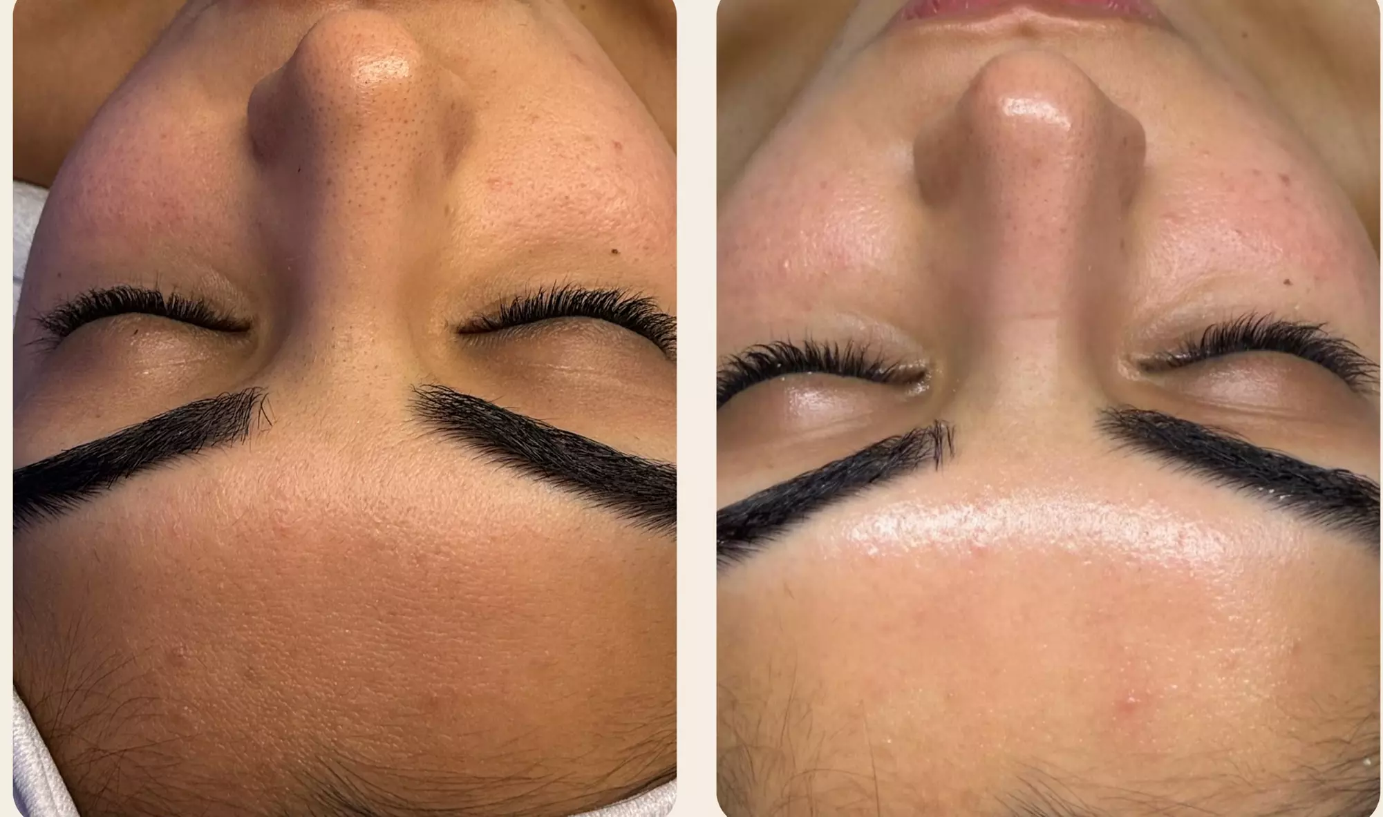 Up to 53% Off on Facial at Gisele Domingos Skincare Specialist