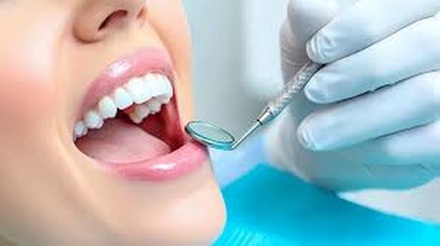 Checkup and X-Ray, Scale and Polish (teeth Cleaning) - CLINIC4U