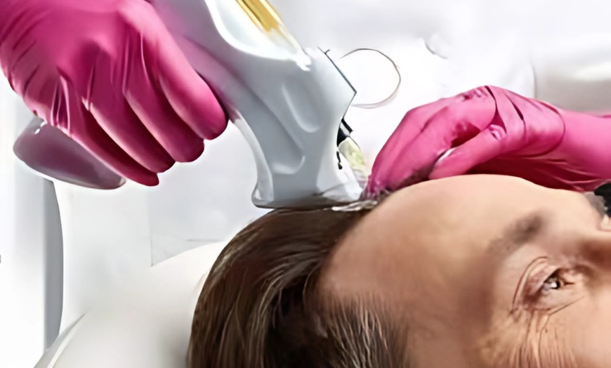 Image 2: Up to 69% Off on Salon - Scalp Care at Glow Matrix