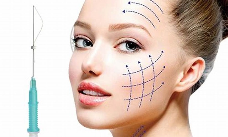 Image 2: Achieve a Youthful Glow with PDO Thread Facelift