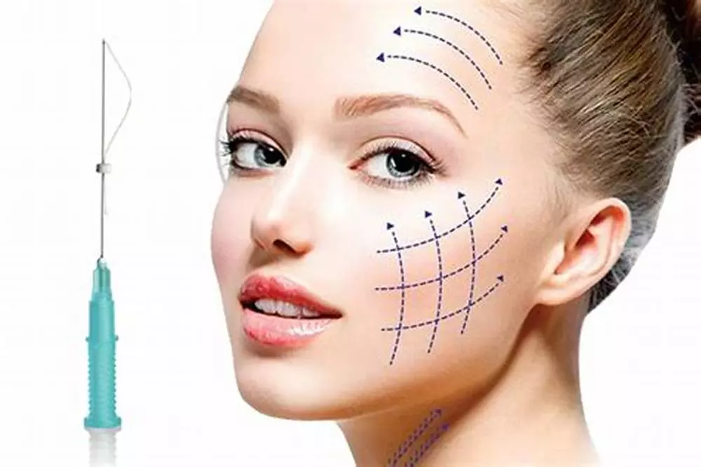 Achieve a Youthful Glow with PDO Thread Facelift (Up to 60% Off) at Time for You
